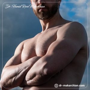 ژنیکوماستی - دکتر حمیدرضا مکارچیان