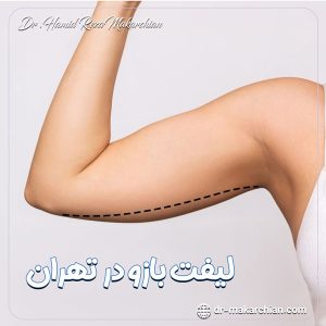 لیفت بازو در تهران - دکتر حمیدرضا مکارچیان