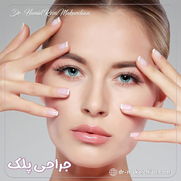 جراحی پلک - دکتر حمیدرضا مکارچیان