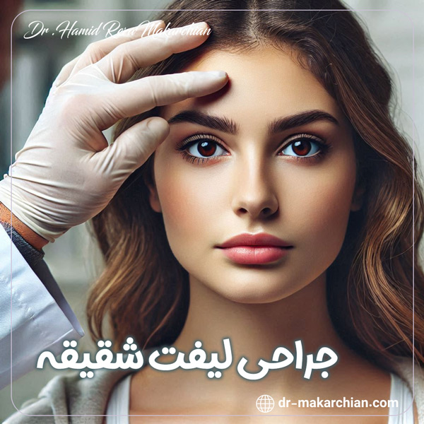 لیفت شقیقه + دکتر حمیدرضا مکارچیان