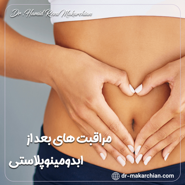 مراقبت های بعد از ابدومینوپلاستی - دکتر حمیدرضا مکارچیان