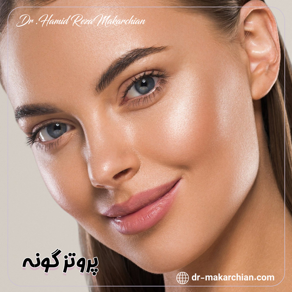 پروتز گونه - دکتر حمیدرضا مکارچیان