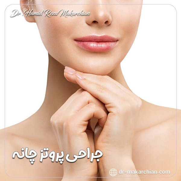 جراحی پروتز چانه - دکتر حمیدرضا مکارچیان