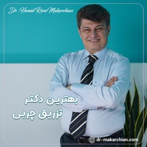 بهترین دکتر تزریق چربی - دکتر حمیدرضا مکارچیان