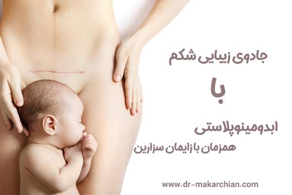  ابدومینوپلاستی همراه با زایمان سزارین - دکتر حمیدرضا مکارچیان