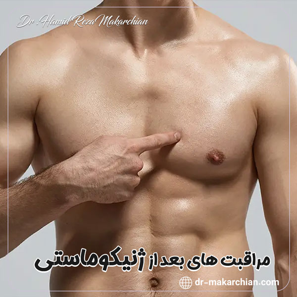 مراقبت‌ های بعد از ژنیکوماستی - دکتر حمیدرضا مکارچیان