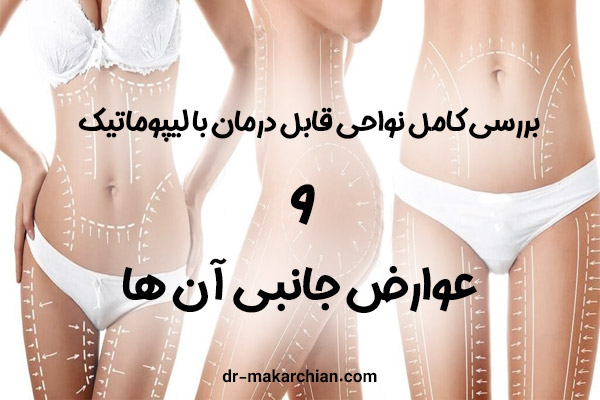 عوارض لیپوماتیک + دکتر حمیدرضا مکارچیان