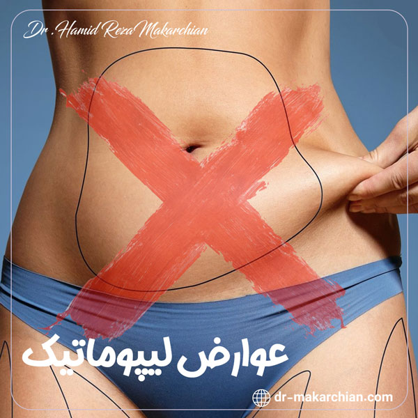عوارض لیپوماتیک - دکتر حمیدرضا مکارچیان