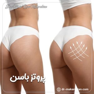 جراحی پروتز باسن + دکتر حمیدرضا مکارچیان