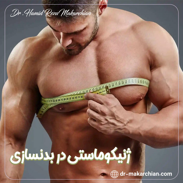 ژنیکوماستی در بدنسازی - دکتر حمیدرضا مکارچیان