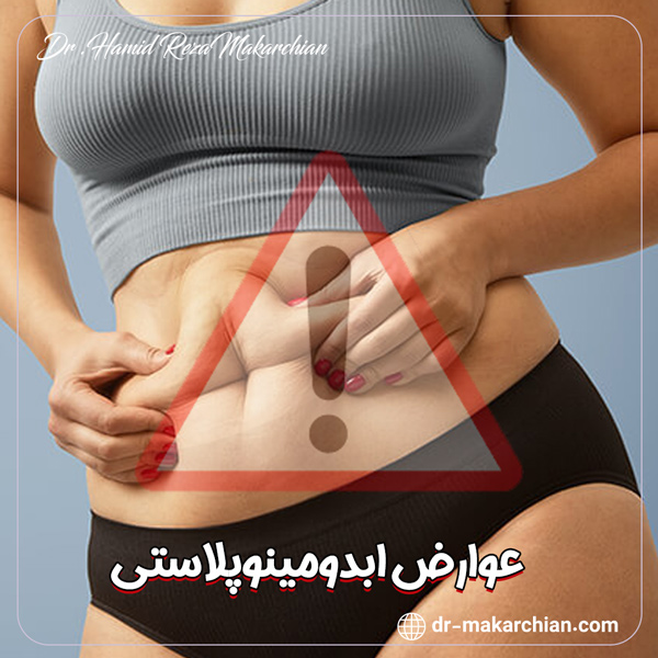 عوارض ابدومینوپلاستی - دکتر حمیدرضا مکارچیان