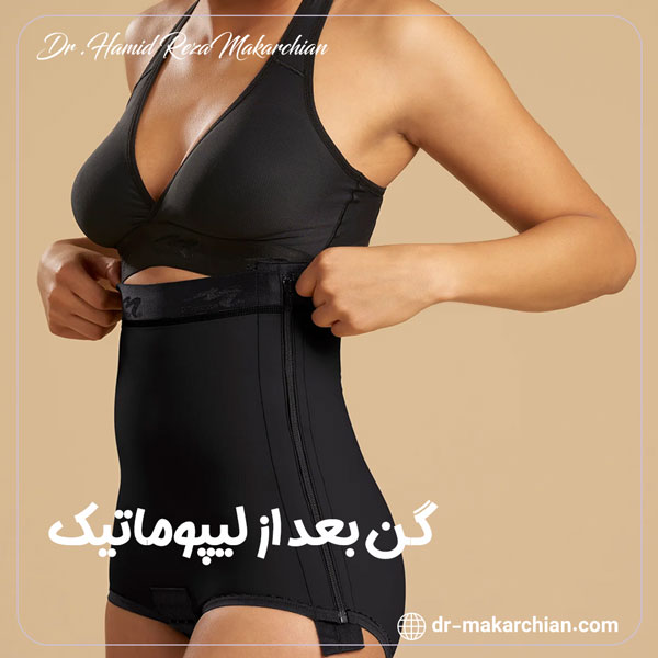 گن بعد از لیپوماتیک - دکتر حمیدرضا مکارچیان