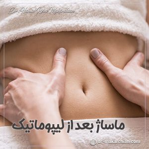 ماساژ بعد از لیپوماتیک - دکتر حمیدرضا مکارچیان