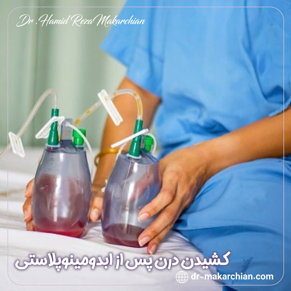 کشیدن درن پس از ابدومینوپلاستی + دکتر حمیدرضا مکارچیان