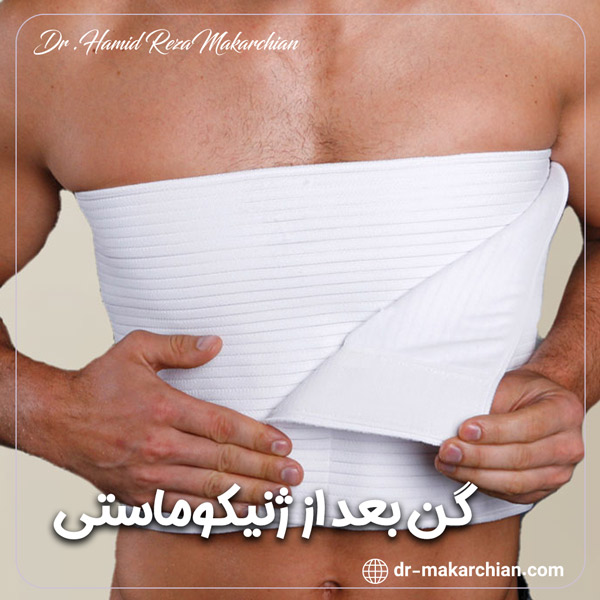 گن بعد از ژنیکوماستی + دکتر حمیدرضا مکارچیان