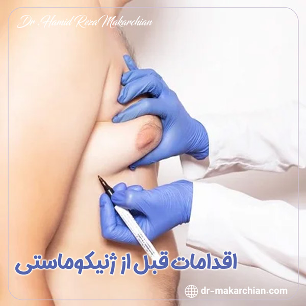 اقدامات قبل از ژنیکوماستی + دکتر حمیدرضا مکارچیان