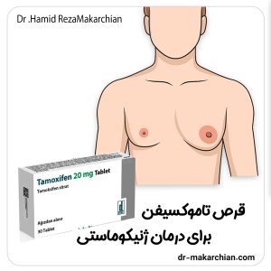 قرص تاموکسیفن برای درمان ژنیکوماستی + دکتر حمیدرضا مکارچیان