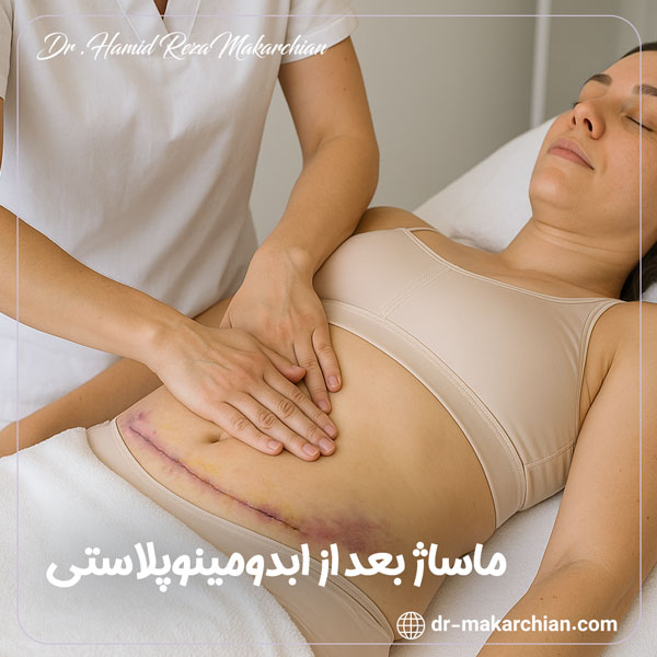 ماساژ بعد از ابدومینوپلاستی + دکتر حمیدرضا مکارچیان