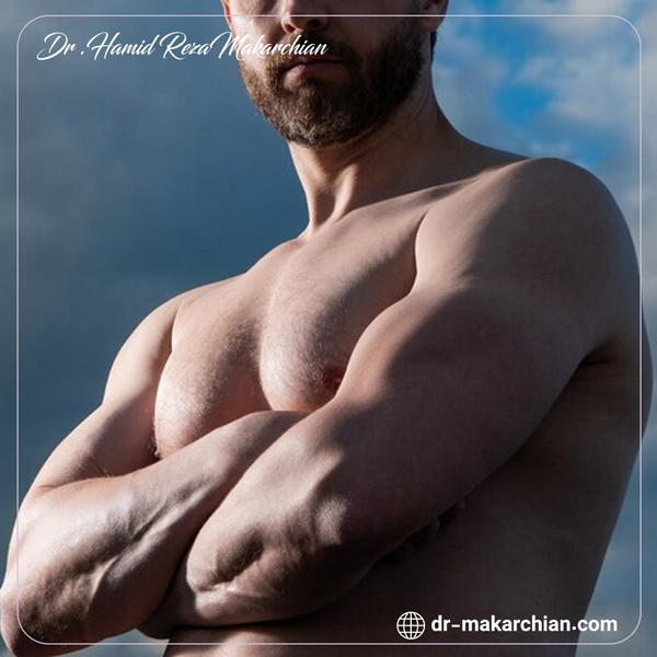 ژنیکوماستی - دکتر حمیدرضا مکارچیان 