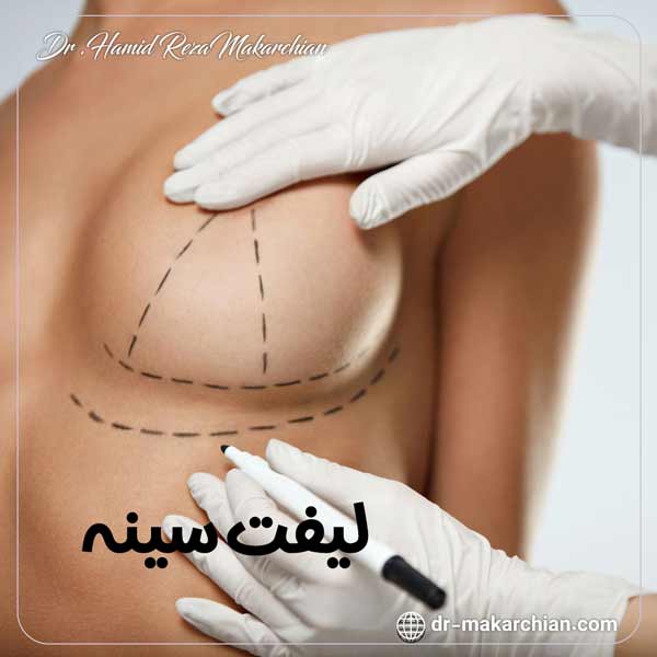 لیفت سینه در تهران - دکتر حمیدرضا مکارچیان