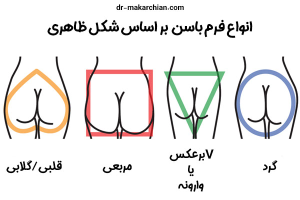 جراحی پروتز باسن + دکتر حمیدرضا مکارچیان