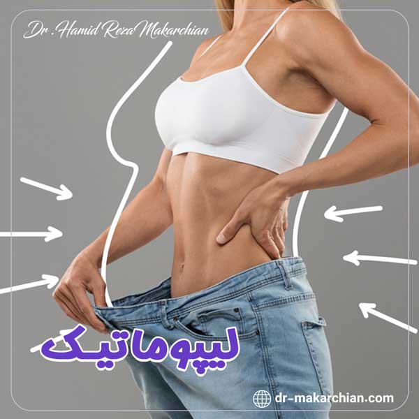 لیپوماتیک - دکتر حمیدرضا مکارچیان
