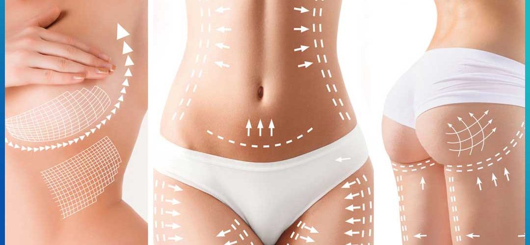 مزایای کلیدی پیکرتراشی با لیپوماتیک ۳۶۰ درجه