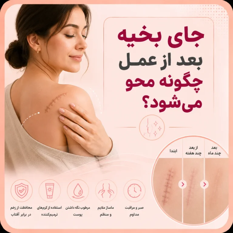 جای بخیه بعد از عمل چگونه محو می‌شود؟