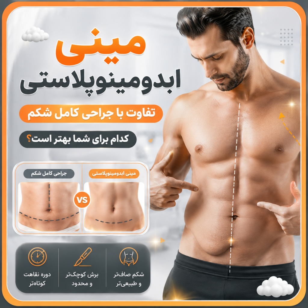 مینی ابدومینوپلاستی