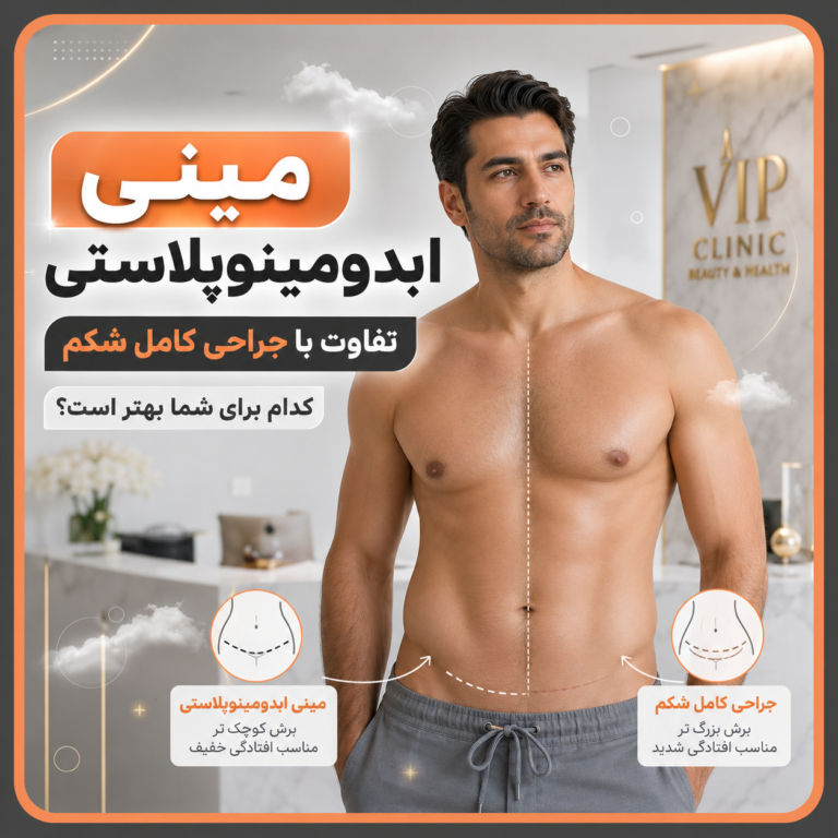 مینی ابدومینوپلاستی یا جراحی کامل؟