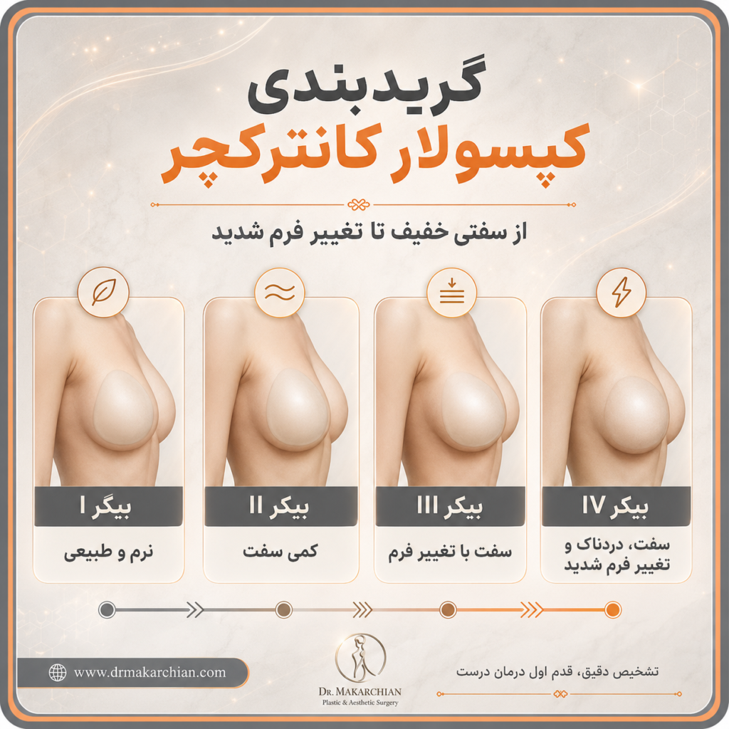 عوارض کپسولار کانترکچر