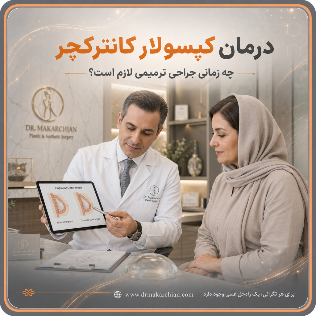 عوارض کپسولار کانترکچر