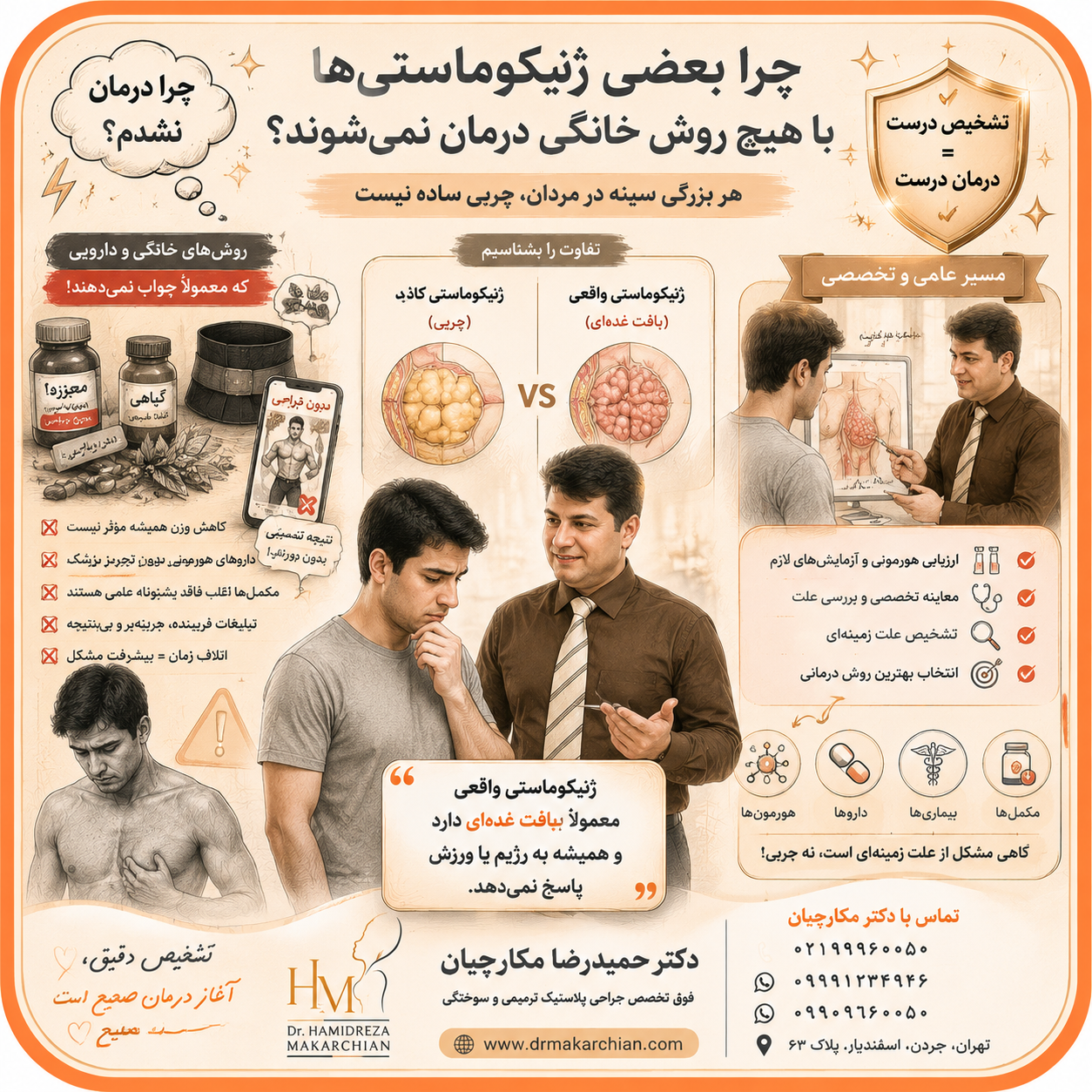 درمان ژنیکوماستی
