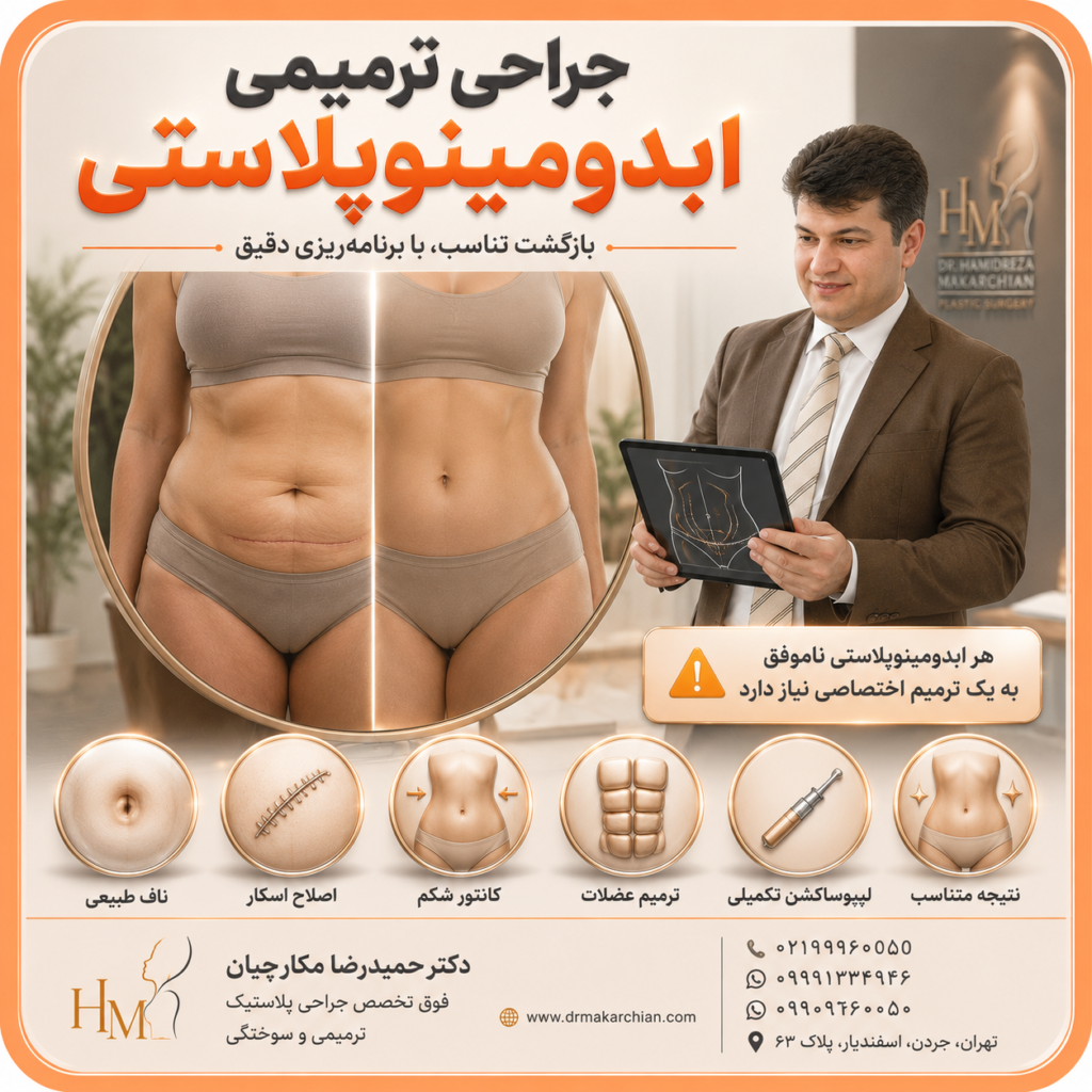 جراحی ترمیمی ابدومینوپلاستی؛ اصلاح نتایج نامطلوب قبلی