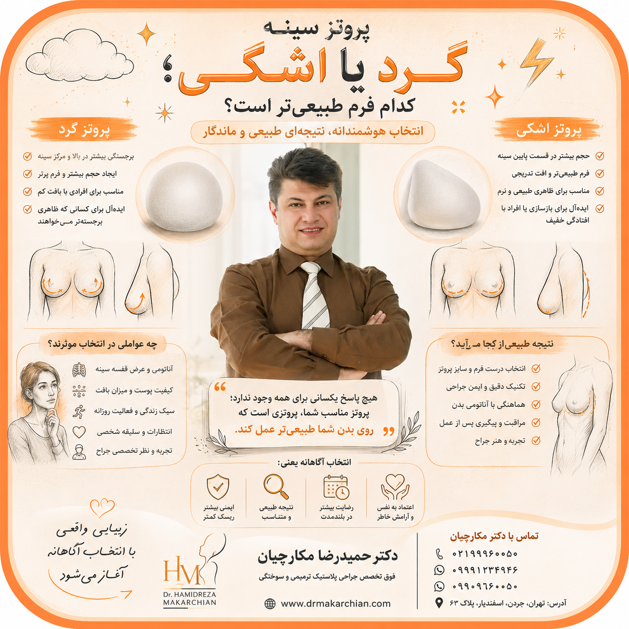 پروتز سینه گرد یا اشکی