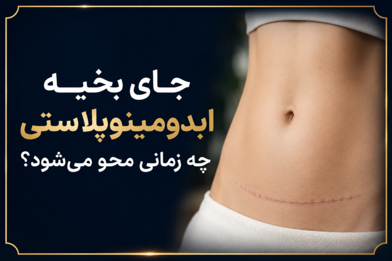 جای بخیه ابدومینوپلاستی6مرحله محوشدن کامل