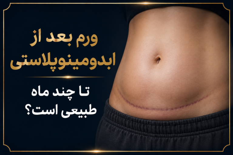 ورم بعد از ابدومینوپلاستی 8مرحله کاهش