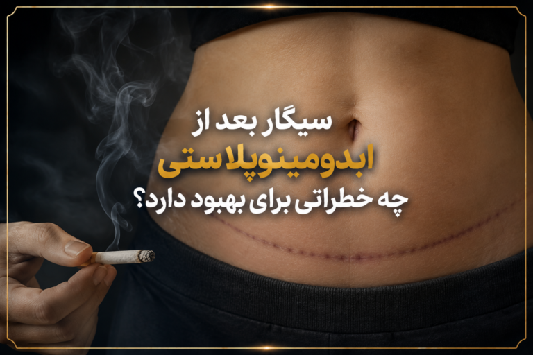 سیگار بعد از ابدومینوپلاستی چه خطراتی برای بهبود دارد؟