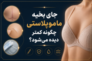 جای بخیه ماموپلاستی چگونه کمتر دیده می‌شود؟