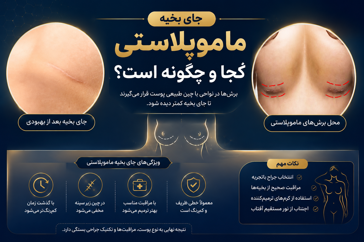 جای بخیه ماموپلاستی 