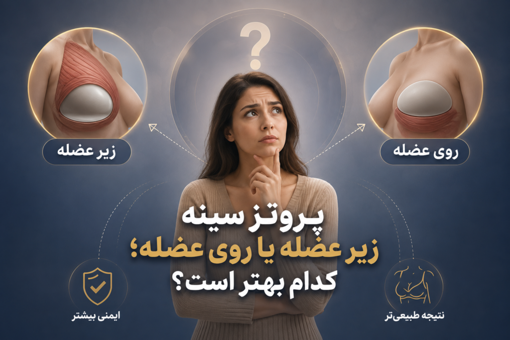 پروتز سینه زیر عضله یا روی عضله؛ کدام بهتر است؟