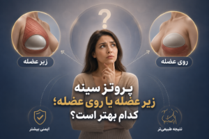 پروتز سینه زیر عضله یا روی عضله؛ کدام بهتر است؟