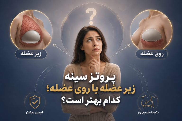 پروتز سینه زیر عضله یا روی عضله؛ کدام بهتر است؟