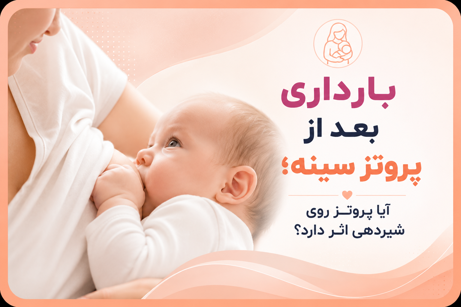 بارداری بعد از پروتز سینه؛ آیا پروتز روی شیردهی اثر دارد؟