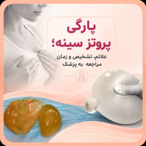 پارگی پروتز سینه؛ علائم، تشخیص و زمان مراجعه به پزشک