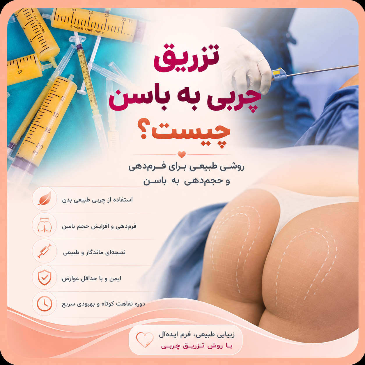 تزریق چربی به باسن