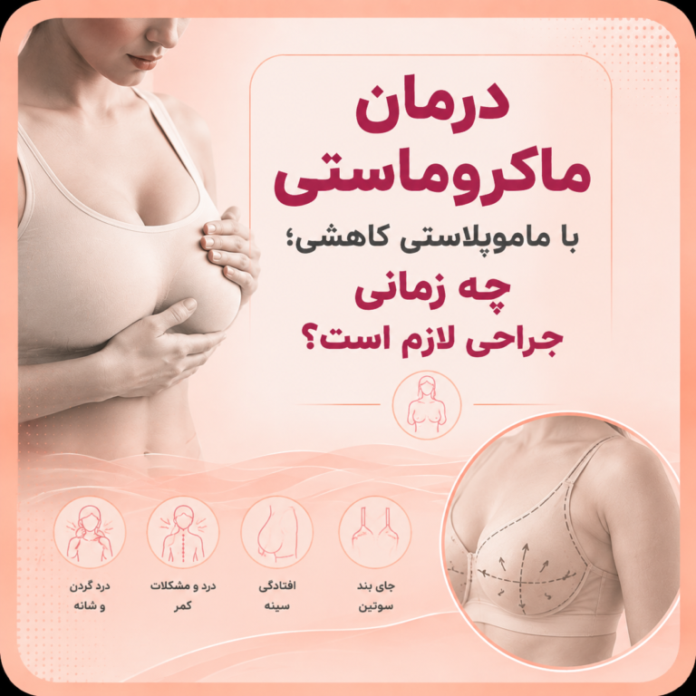 درمان ماکروماستی