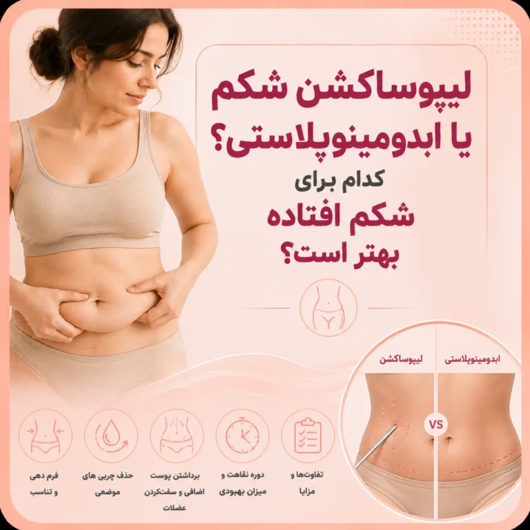 لیپوساکشن شکم یا ابدومینوپلاستی؟ کدام برای شکم افتاده بهتر است؟