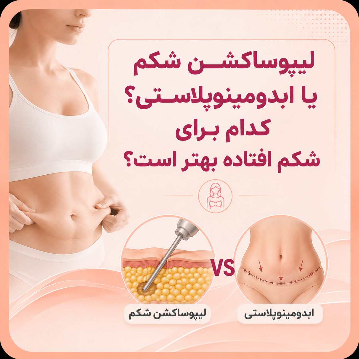 لیپوساکشن شکم یا ابدومینوپلاستی؟ کدام برای شکم افتاده بهتر است؟