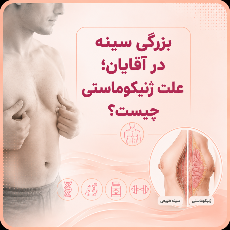 بزرگی سینه در آقایان؛ علت ژنیکوماستی چیست؟